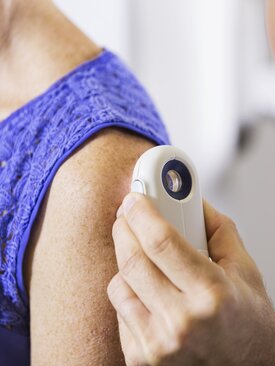 Dermatologe untersucht mit Handdermatoskop die Haut einer Patientin am Oberarm