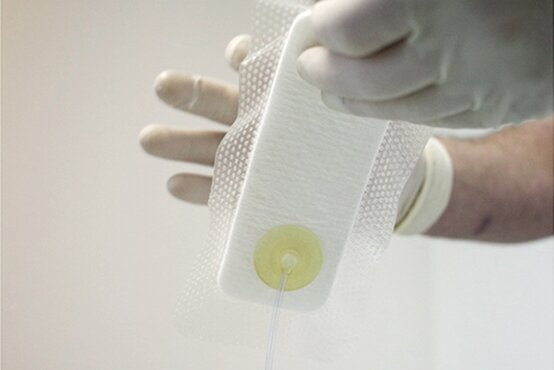 Nahaufnahme einer Hand mit Einmalhandschuh hält transparenten Verband mit Wundauflage und Drainageanschluss