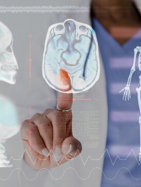 Finger zeigt auf digitales MRT-Bild eines Gehirns, Symbolbild neurologische Diagnostik