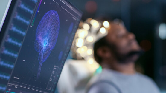 Monitor mit 3D-Visualisierung der Gehirnaktivität, Person mit EEG-Haube im Hintergrund während neurologischer Untersuchung