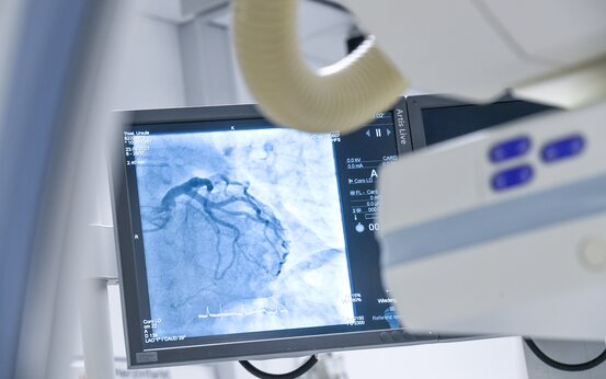 Monitor zeigt Angiogramm einer Koronarangiographie im Herzkatheterlabor, medizinisches Untersuchungsgerät im Vordergrund
