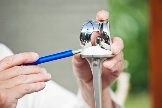 Arzt zeigt mit Stift auf künstliches Kniegelenk