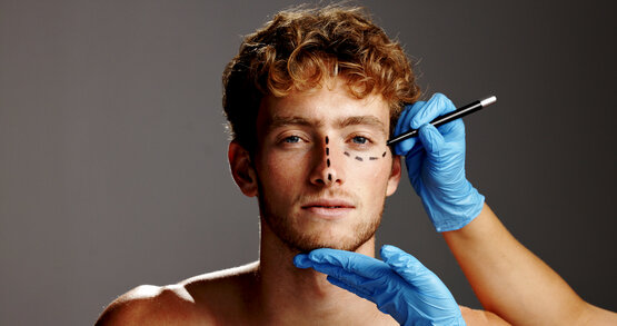 Behandschuhte Hände zeichnen präoperative Markierungslinien auf das Gesicht eines jungen Mannes mit Stift