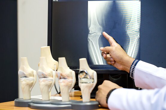 Arzt zeigt auf Knie-Röntgenbild am Bildschirm, mehrere Kniegelenk-Modelle im Vordergrund auf dem Tisch
