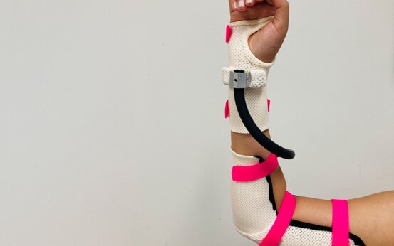 Arm mit individuell angepasster Orthese und pinken Gurten zur Stabilisierung bei Therapie in der Ergotherapie