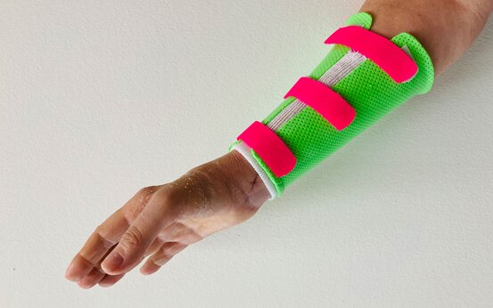 Rechte Hand eines Patienten mit transparenter Fingerschiene und pinkem Klettverschluss