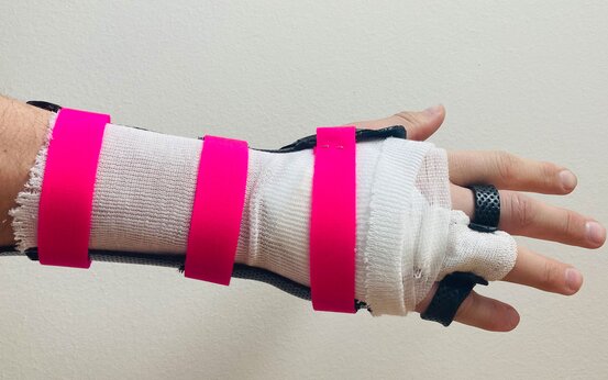 Unterarm und Hand mit Verband, schwarzer Handgelenkschiene und drei pinken Klettverschlüssen, Daumen bandagiert, schwarze Ringe an Zeige- und Mittelfinger