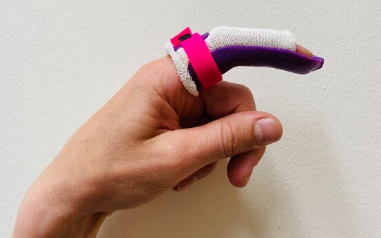 Zeigefinger mit lila Fingerschiene, weißem Polster und pinkem Klettband ruhiggestellt
