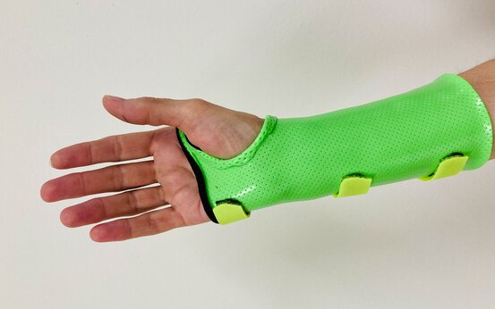 Unterarm mit grüner, perforierter Schiene und gelben Klettverschlüssen
