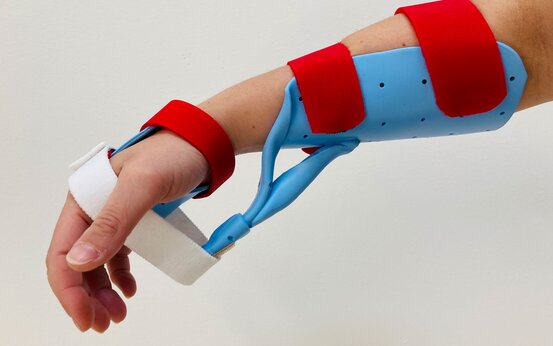 Unterarm mit blauer Schiene und roten Klettverschlüssen, Hand in neutraler Position