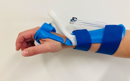 Unterarm mit blauer und weißer Handorthese aus Kunststoff und Klettverschlüssen, Zugdrähte zur Fingerunterstützung