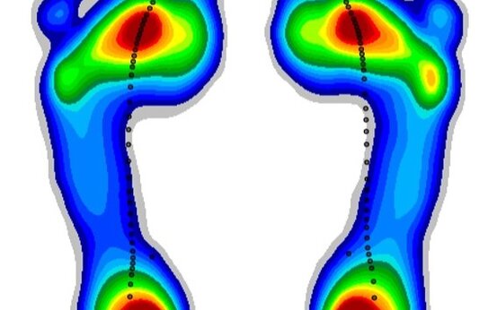 Farbliche Druckverteilung beider Fußsohlen als Ergebnis einer Ganganalyse, Grafik zeigt hohe Druckzonen in Rot im Ganglabor zur Fußdiagnostik
