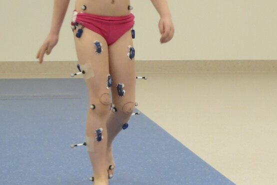 Kind mit reflektierenden Markern und Sensoren an Beinen bei Ganganalyse 