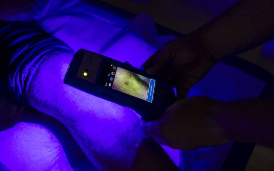 Medizinisches Personal mit medizinisxchem Gerät scannt eine Verletzung am Bein eines Patienten in dunklem Raum