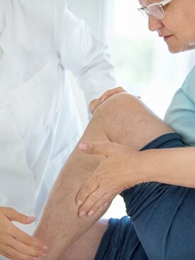 Ärztin im weißen Kittel untersucht das linke Bein einer sitzenden Person mit Brille, bläuliche Venen am Bein deutlich sichtbar